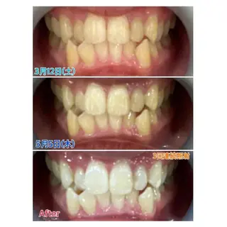 M渋谷店所属・M渋谷 ホワイトニングのエステ・リラクイメージ