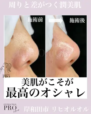 毛穴汚れ改善専門店/ 岸和田/リヒオルオルのエステ・リラクイメージ