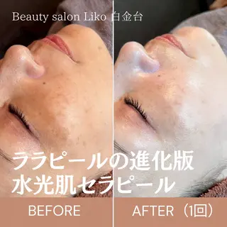 Beauty salon  Liko所属・LIKO フェイシャル&ボディのエステ・リラクイメージ