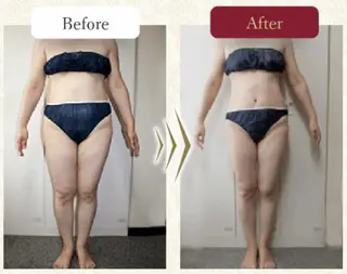 温活beautyサロンNeroli所属・切らない脂肪吸引🔥 Neroliまりこのエステ・リラクイメージ