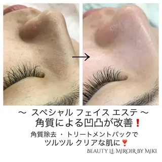 ビューティー ミロワールのエステ・リラクイメージ