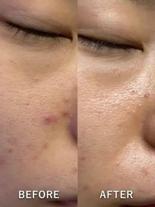 LukeBeauty salonのエステ・リラクイメージ