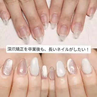 ネイル 深爪矯正/爪育成ケア manie nailのネイルデザイン