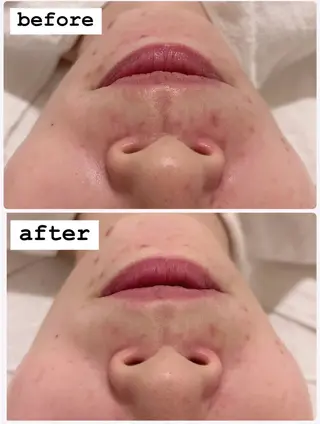 POLA THE BEAUTY 堺東店所属・肌管理🌿毛穴改善 POLA堺東のエステ・リラクイメージ