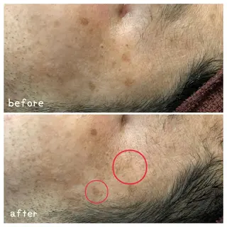 🐰 坂本 麗 🐰の眉毛・アイブロウイメージ