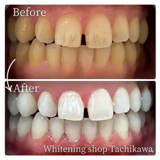 セルフ ホワイト ニングショップ立川のその他イメージ