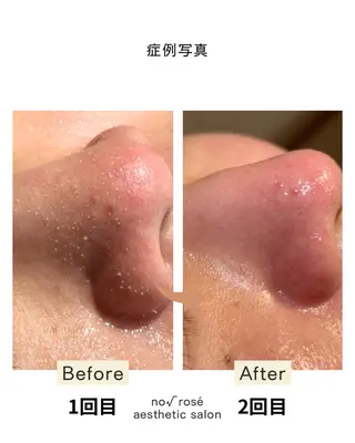 ノールート ロゼのエステ・リラクイメージ