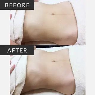 Private Relaxation Salon yoi所属・yoi 北千束のエステ・リラクイメージ