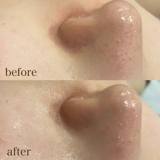 DahliaBeauty ダリアビューティー所属・Dahlia痩身脱毛 フェイシャル 中村のエステ・リラクイメージ