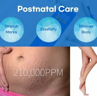 代表 MOMOのエステ・リラクイメージ