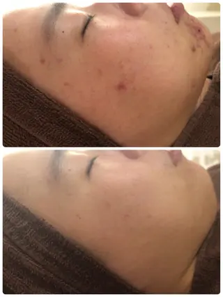 ミディアム カラー パーマ ヘアアレンジ メンズ キッズ ネイル マツエク・マツパ ニキビ・肌質改善専門 ♡人生が変わるサロンのエステ・リラクイメージ