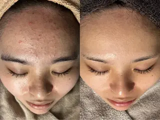 rejena 山口のエステ・リラクイメージ