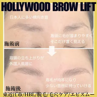 アイブロウ epismoo 脱毛/HBL/毛穴の眉毛・アイブロウイメージ