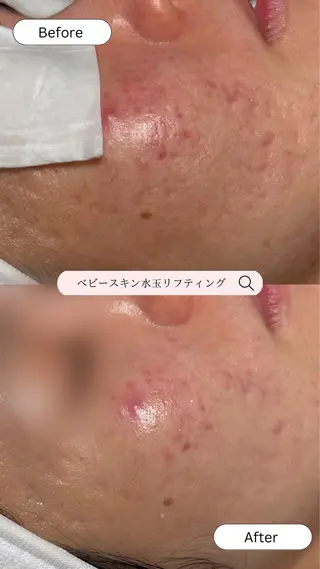 韓国肌管理🫧LDM 🫧Junnaのエステ・リラクイメージ