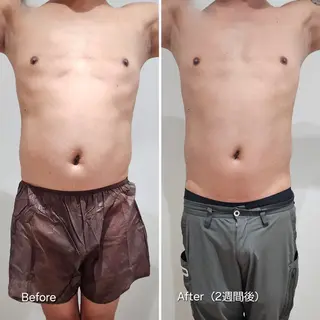 脂肪冷却 & 脱毛 AYUMIのその他イメージ