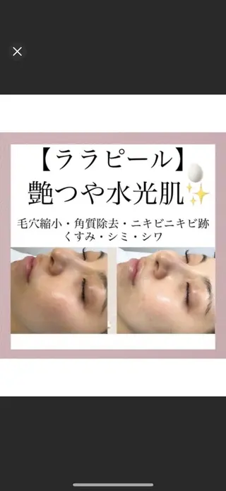 メディカルエステ マドンナのエステ・リラクイメージ