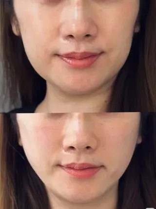 aliaハイフ&水光ジェットサロン所属・aliaハーブ水光店 エステティシャン募集のエステ・リラクイメージ