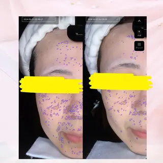 肌専門パーソナルエステサロンみゅうる所属・田村 由佳のその他イメージ