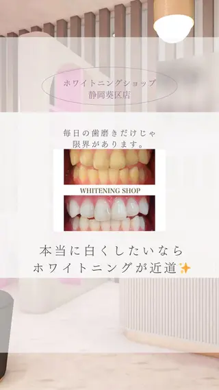 ホワイトニングショップ静岡葵区店所属・ホワイトニング ショップ葵区静岡駅店のその他イメージ