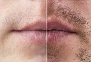 Men'sエステ/ メンズ脱毛ツインズのエステ・リラクイメージ