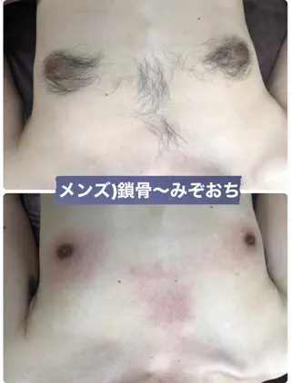 メンズ ブラジリアン☆WAX 🎖🌚YUKI🌚のエステ・リラクイメージ