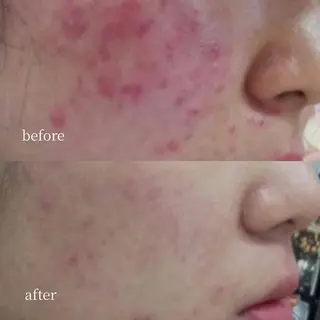 韓国肌管理・肌質改善 EARNEST心斎橋のエステ・リラクイメージ