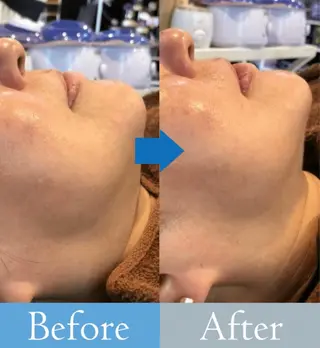 美肌/小顔/眉毛の 専門店 ルミナスのエステ・リラクイメージ