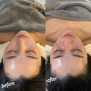 うなじ脱毛/美肌脱毛 LABELのエステ・リラクイメージ