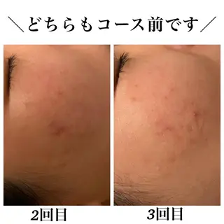 Bellesthe （ベルエステ）のエステ・リラクイメージ