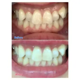 MBEAUTYSALON 千葉店・京成大久保所属・Melty 輝のその他イメージ