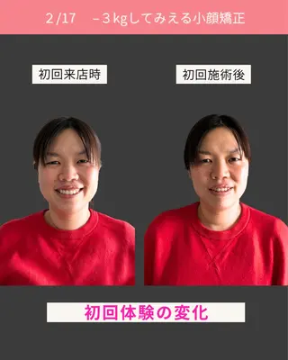 Noelie所属・美肌&小顔矯正 Noelieのエステ・リラクイメージ