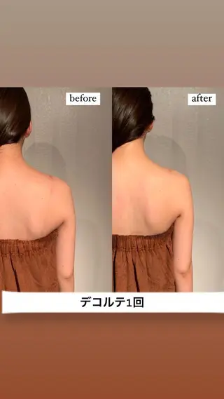 エステサロンino.colore'所属・小顔サロン ino.coloreのエステ・リラクイメージ