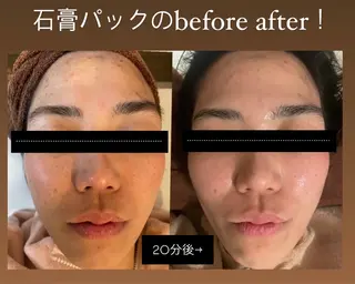 脱毛🌈Beauty Salon新宿店のエステ・リラクイメージ