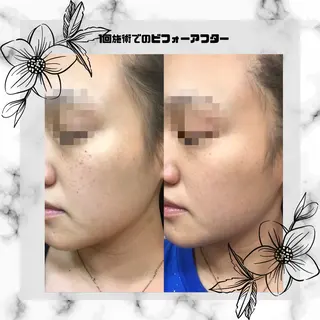 男女同額完全個室脱毛 LEPIA内田のエステ・リラクイメージ