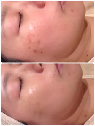 調律エステ /美KISSのその他イメージ