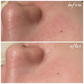 メンズ メナード岐阜市茜部 杉浦のエステ・リラクイメージ