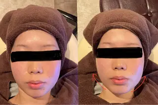 【痩身ダイエット・リンパオイルマッサージ・脱毛】- iromie. 四日市店 - 医療提携所属・佐々木 千愛来のエステ・リラクイメージ