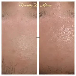 ビューティー ミロワールのエステ・リラクイメージ