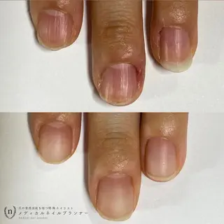 ネイル tsuki elfのエステ・リラクイメージ