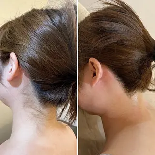 うなじ脱毛/美肌脱毛 LABELのエステ・リラクイメージ