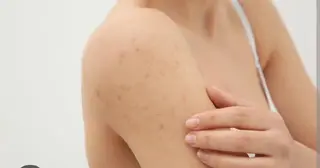 ☺ハーブピール💕 ソフィアカロン💖のエステ・リラクイメージ