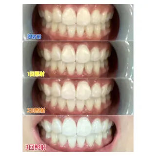 MBEAUTYSALON 千葉店・京成大久保所属・Melty 輝のその他イメージ