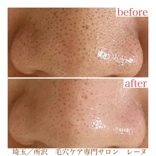 毛穴ケア専門サロン レーヌのエステ・リラクイメージ