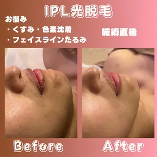 効果重視脱毛サロンRICE所属・肌質改善/都度脱毛 Mahinaのエステ・リラクイメージ