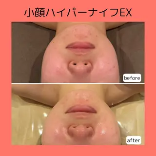 赤澤/本気痩せ・脱毛 ・ノーファンデ肌のその他イメージ