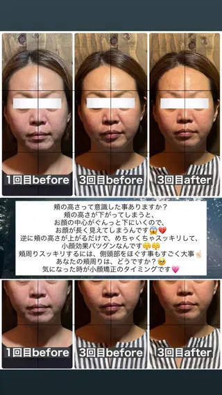 💎後悔させない小顔 矯正💎イトヤマ🌱のエステ・リラクイメージ