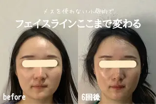 最速小顔・肌質管理 espoirマキのエステ・リラクイメージ