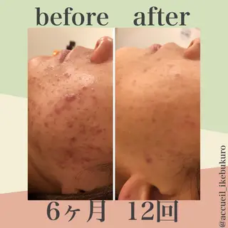 ミディアム カラー パーマ ヘアアレンジ メンズ キッズ ネイル マツエク・マツパ ニキビ・肌質改善専門 ♡人生が変わるサロンのエステ・リラクイメージ