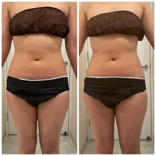 ララ/ハーブ メゾンリュバンのエステ・リラクイメージ