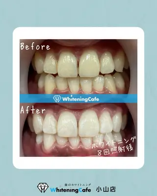 ホワイトニングカフェ 小山店のエステ・リラクイメージ